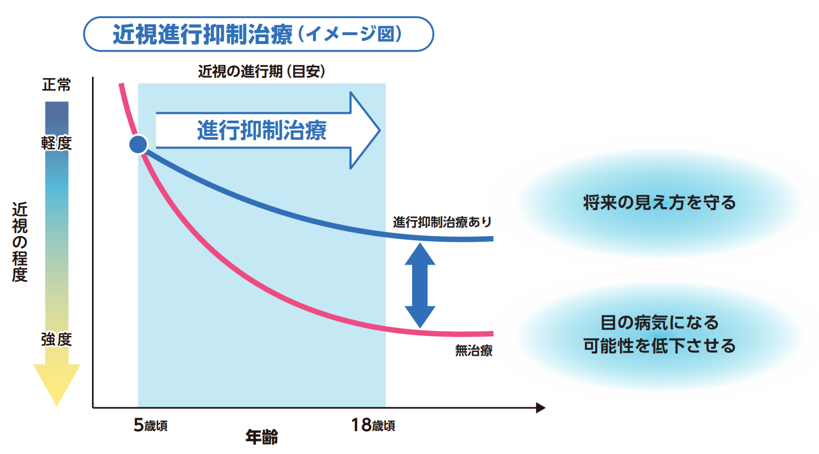 近視抑制期待カーブ